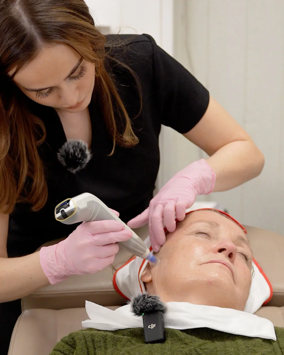 Dermapen microneedling utf&oslash;res p&aring; en kunde
